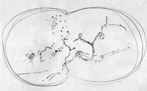 Figure 1: Shining structure floaters: Semi-transparent, mobile dots and strings in the visual field.